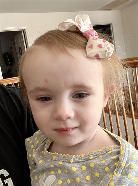 Fiona's Story - Edwards Syndrome Association