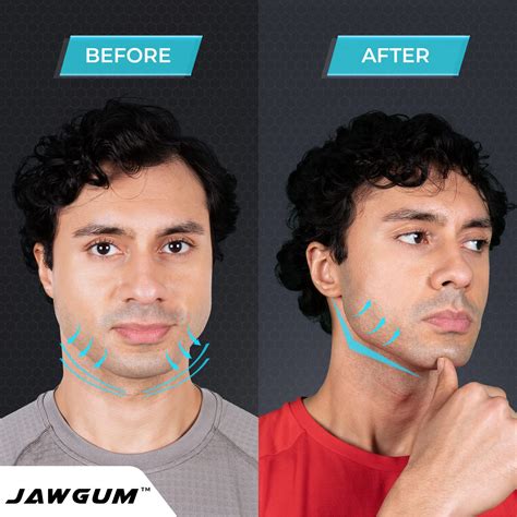 Does Chewing Gum Helps Reduce Face Fat Cheap Sale | varsana.com