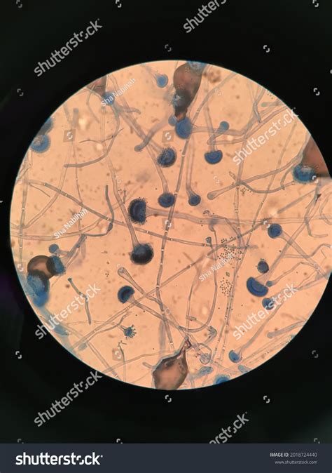 aspergillus  microscope shape