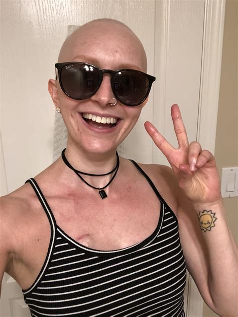 Top 10 “Strange” Side Effects I had from Cancer Treatment — She Stays