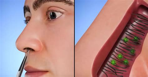 how to pluck nose hairs