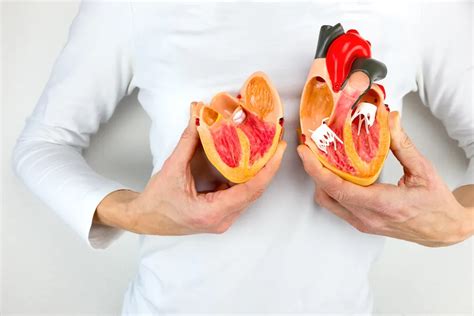 Congestive Heart Failure: Symptoms, Causes, and Treatments – ActiveBeat ...