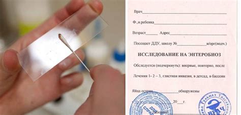 Анализ на энтеробиоз: важность процедуры, рекомендации по подготовке ...