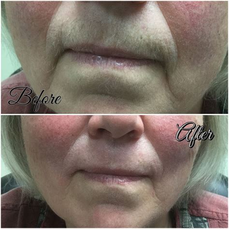 Should You Wash Your Face After Waxing at Ruben Williams blog