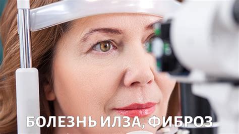 Болезнь Илза и эпиретинальный фиброз: как сохранить зрение? - YouTube