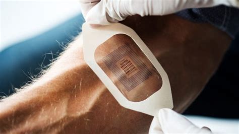 smart wearable insulin patch  revolutionise diabetes treatment