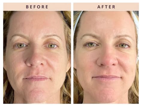 CoolPeel - Spa Me Now