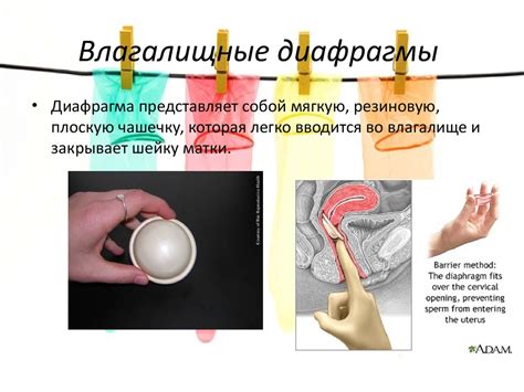 Методы контрацепции - презентация онлайн