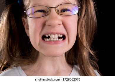 Little Girl Shows Crooked Teeth On Stock Photo 1723197565 | Shutterstock