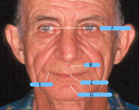 oral anatomy  maxilla flashcards quizlet