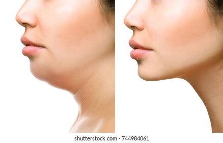 human body parts chin royalty  images stock