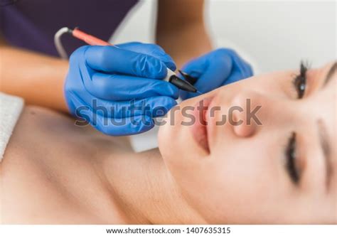 Dermatologist Doing Hair Removal Treatment On Stock Photo 1407635315 ...