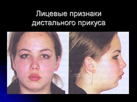 Дистальная окклюзия - презентация онлайн