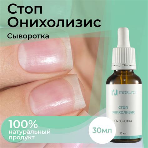Masura , Сыворотка Стоп Онихолизис , 30 мл с пипеткой 8097 - купить с ...