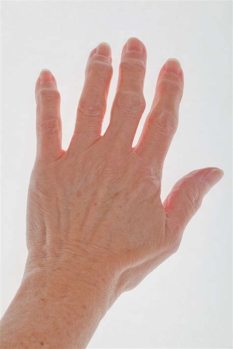 News | Surgical Sports