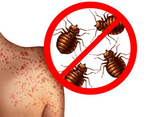 early signs  bed bug infestation heat rx