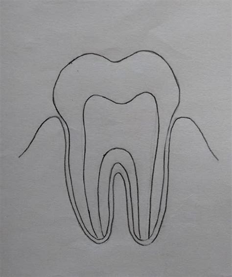 DRAW IT NEAT: How to draw tooth diagram labeled.
