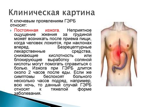 Гастроэзофагеальная рефлюксная болезнь - презентация онлайн