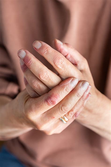 Best Chronic and Autoimmune Diseases Treatment - Terrain Health