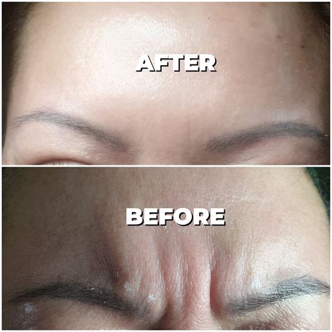 Medical students debate the fairness of the dermatology pa salary 2