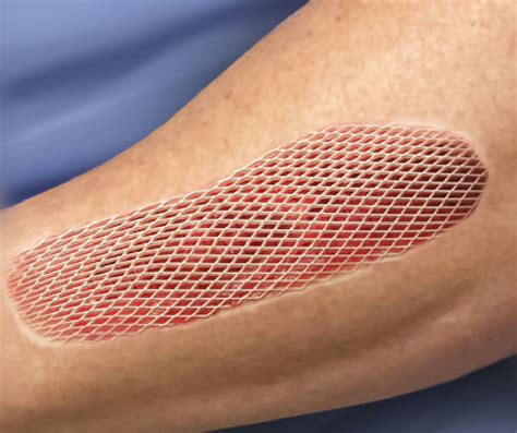 Looking For A Wound Care Specialist In Orlando? Call Us Today!