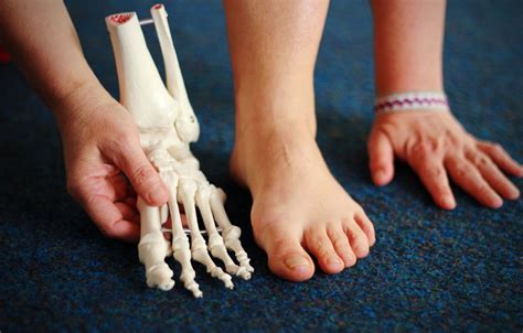 zdrave nohy po cely zivot blog jolana novotna