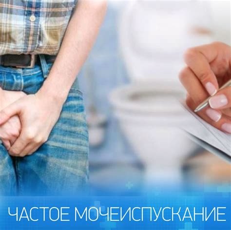 Частое мочеиспускание – это норма? – NEO-Сlinic Тюмень