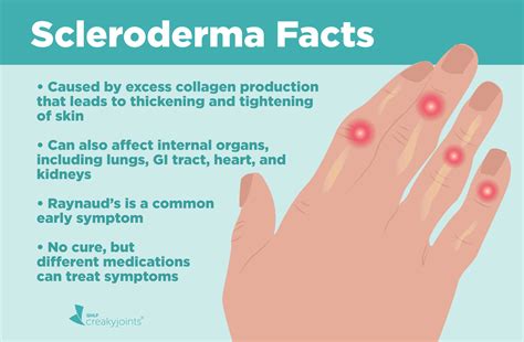 What is Scleroderma? Understanding Symptoms, Causes, and Treatments