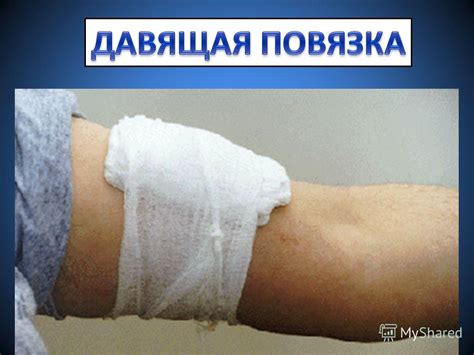 Презентация на тему: "Первая медицинская помощь при кровотечении ...