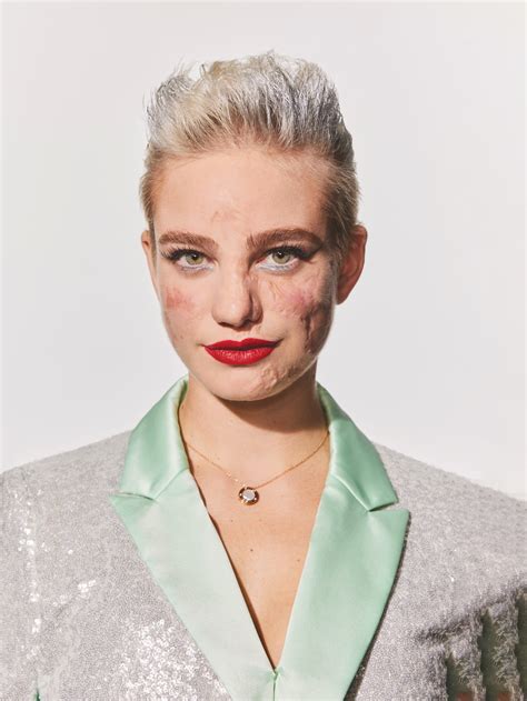 Paralympian Bebe Vio Isn’t Hiding Her Disability — Or Her Scars