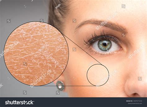33,822 Girl dry skin Images, Stock Photos & Vectors | Shutterstock