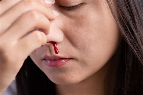 types  bleeding