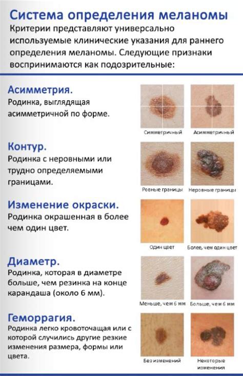 Лечение меланомы: можно ли вылечить и состояние после операции