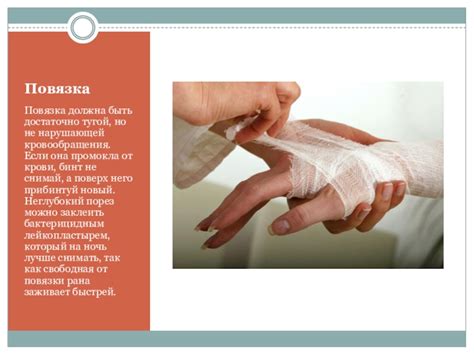 Как сделать порезы на руке: Ох, рана: опасная мода набирает ...