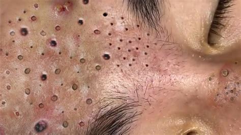 Enjoy Everyday With Loan Nguyen Skincare - YouTube