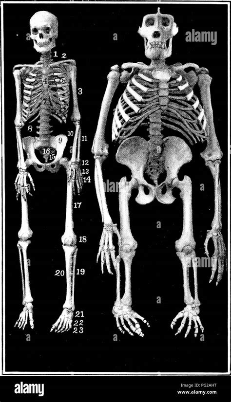 Cervical vertebrae 7 hi-res stock photography and images - Alamy