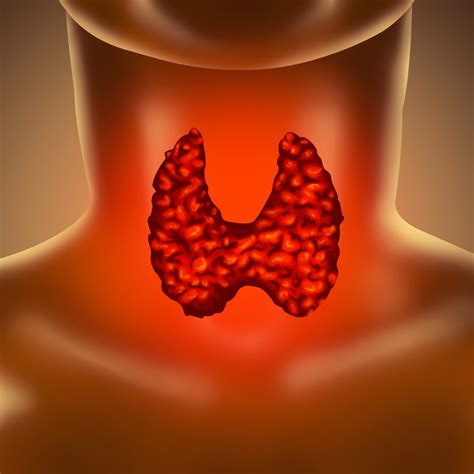 4 Common Thyroid Disorders and Their Symptoms - Health Zone
