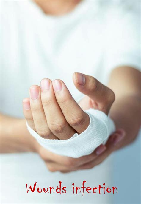 SOLUTION: Wounds infection injuries - Studypool