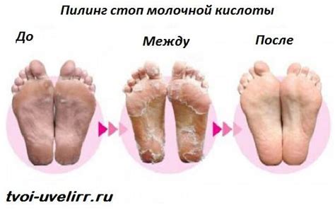 Молочна кислота. Властивості і застосування молочної кислоти