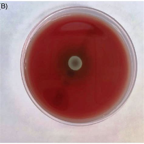 Swarming characteristics of Proteus mirabilis at different temperatures ...