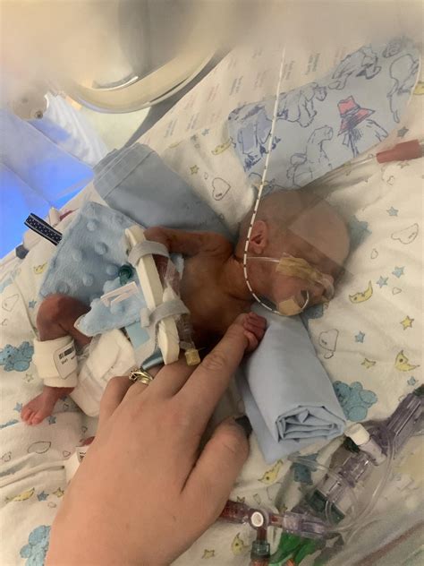 Premature Baby Wedding