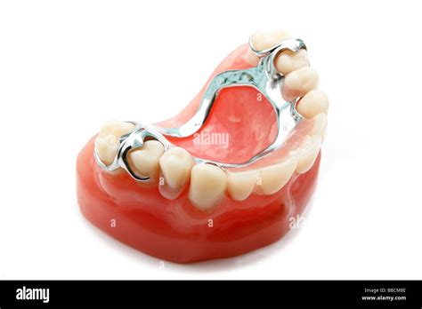 Partial denture on acrylic model Stock Photo - Alamy