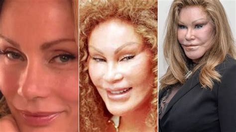 Mugshot Of Jocelyn Wildenstein Released As She Appear - vrogue.co