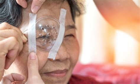What to Expect with Cataract Surgery: Before, During and After - Swagel ...