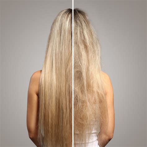 repair  treat winter hair damage zenagen hair loss treatment