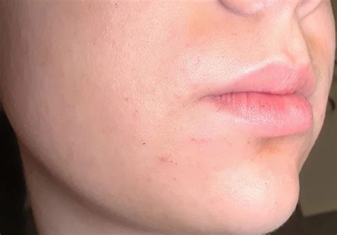 Ausschlag von abschminken? (Beauty, Haut)