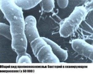 В каких продуктах содержатся пропионовокислые бактерии