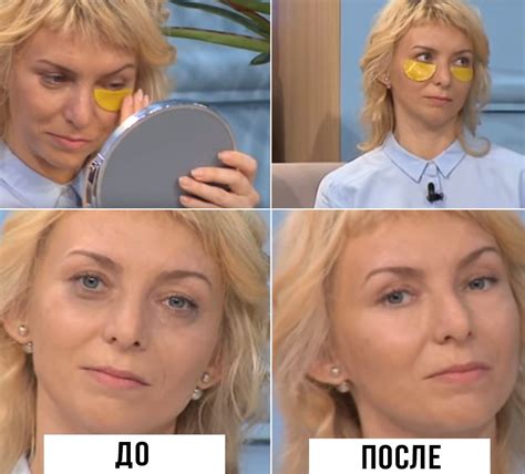 Как быстро убрать мешки под глазами