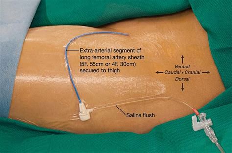diagram male groin diagram mydiagramonline