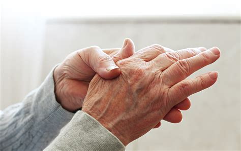 Systemic scleroderma: diagnosis and treatment in the best clinics